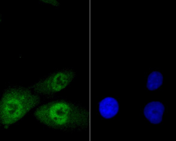 GLI1 Antibody in Immunocytochemistry (ICC/IF)