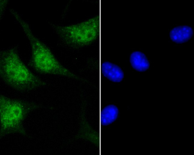 GLI1 Antibody in Immunocytochemistry (ICC/IF)