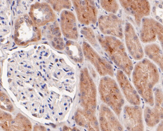 GLI1 Antibody in Immunohistochemistry (Paraffin) (IHC (P))