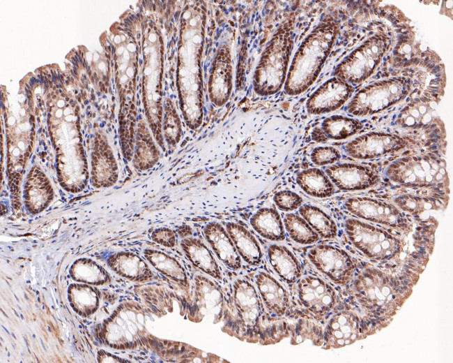 KDM2A Antibody in Immunohistochemistry (Paraffin) (IHC (P))