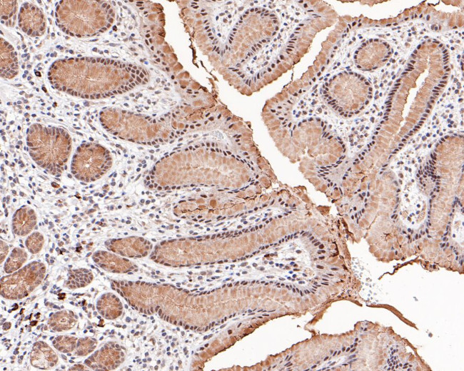 KDM2A Antibody in Immunohistochemistry (Paraffin) (IHC (P))