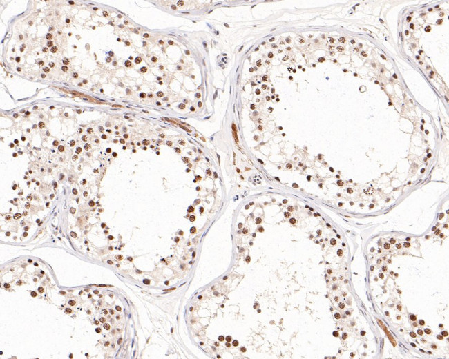 TBP Antibody in Immunohistochemistry (Paraffin) (IHC (P))