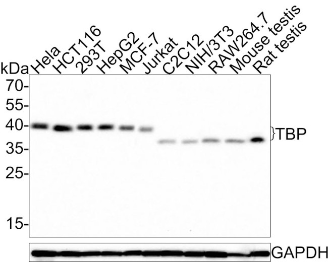 TBP Antibody in Western Blot (WB)