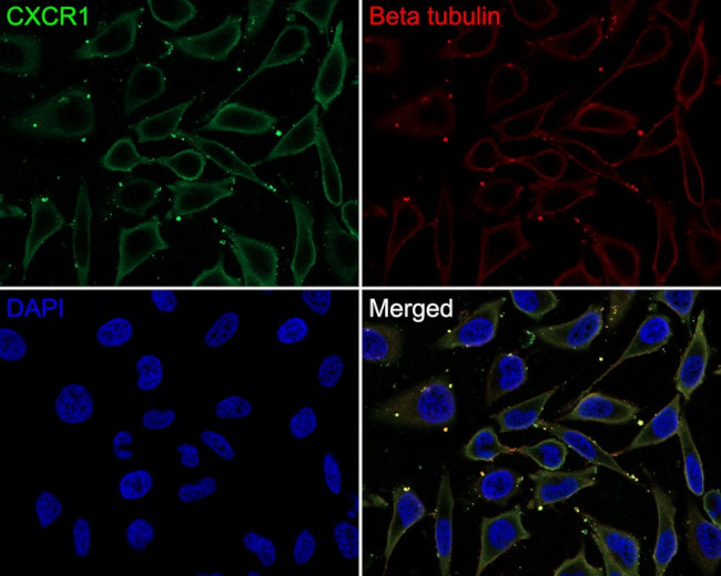 CXCR1 Antibody in Immunocytochemistry (ICC/IF)