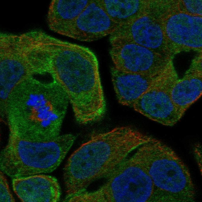 RAB25 Antibody in Immunocytochemistry (ICC/IF)