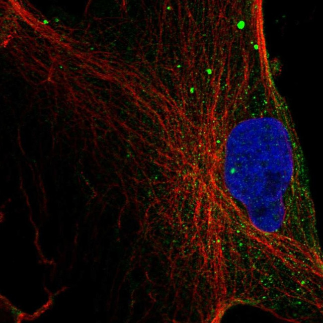 Monoacylglycerol Lipase Antibody in Immunocytochemistry (ICC/IF)