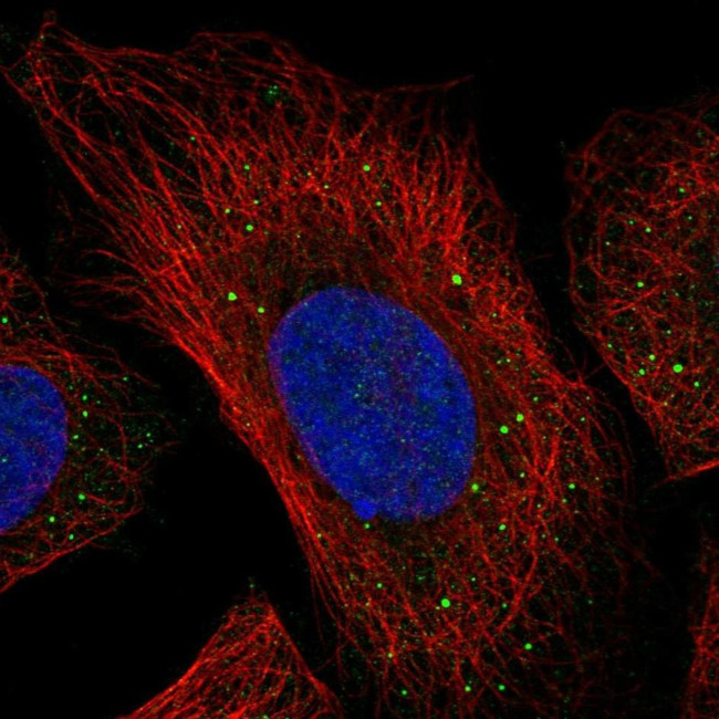 p40 Antibody in Immunocytochemistry (ICC/IF)