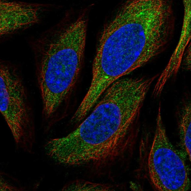 CNOT1 Antibody in Immunocytochemistry (ICC/IF)