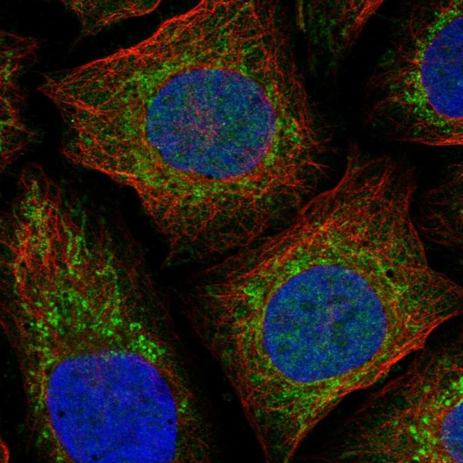 NDUFAF4 Antibody in Immunocytochemistry (ICC/IF)