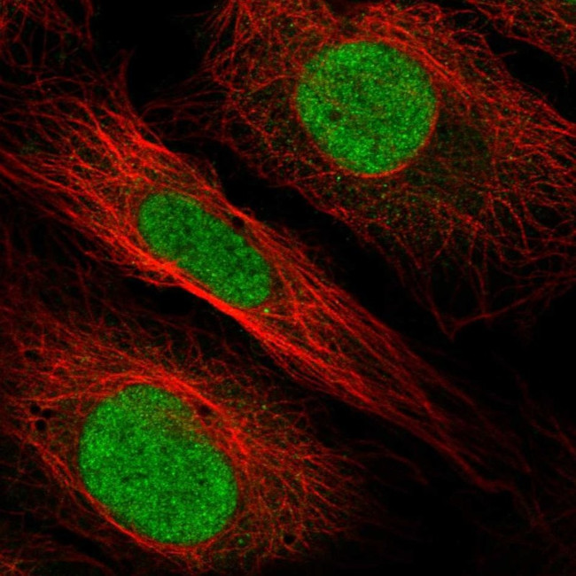 HOXB1 Antibody in Immunocytochemistry (ICC/IF)