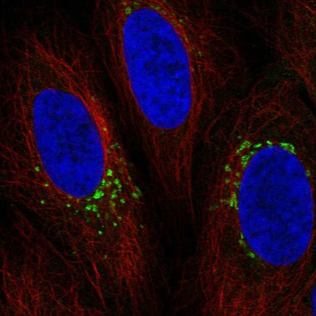 SH3BP2 Antibody in Immunocytochemistry (ICC/IF)