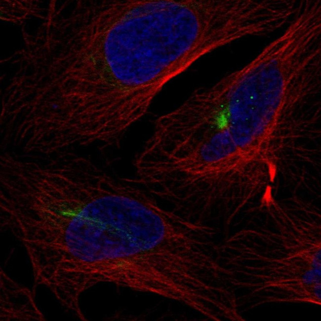 KRT74 Antibody in Immunocytochemistry (ICC/IF)