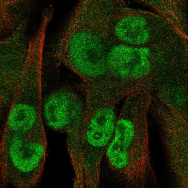 KCTD15 Antibody in Immunocytochemistry (ICC/IF)