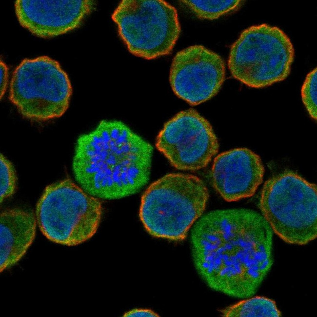 GPR40 Antibody in Immunocytochemistry (ICC/IF)