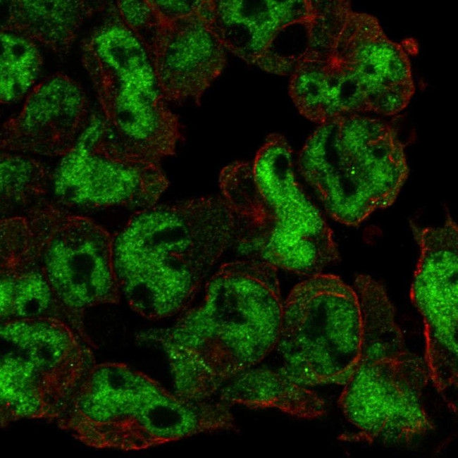 UBASH3A Antibody in Immunocytochemistry (ICC/IF)