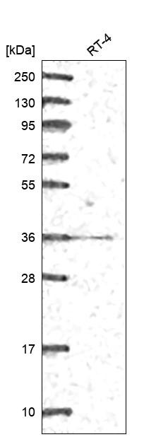 GGPS1 Antibody in Western Blot (WB)