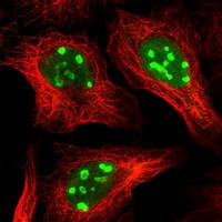 ZMYND8 Antibody in Immunocytochemistry (ICC/IF)