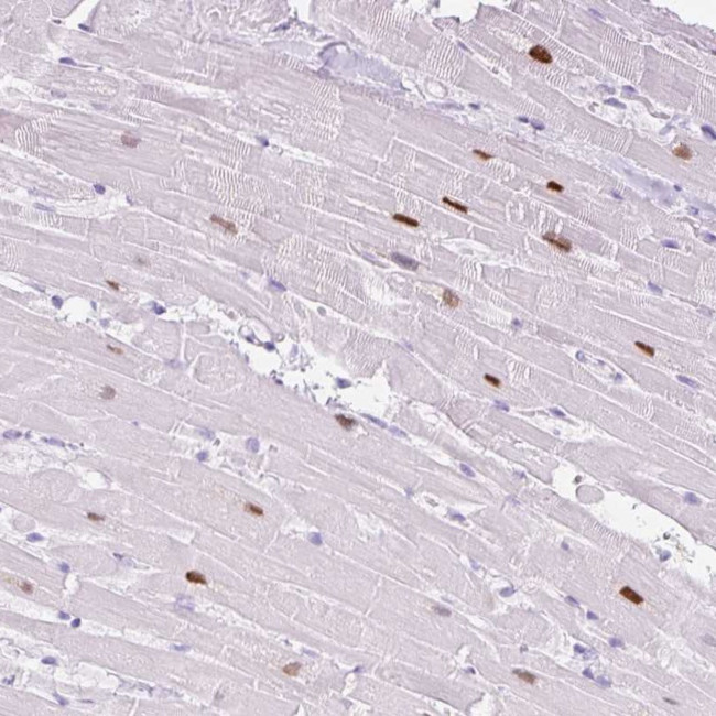 ADSSL1 Antibody in Immunohistochemistry (Paraffin) (IHC (P))