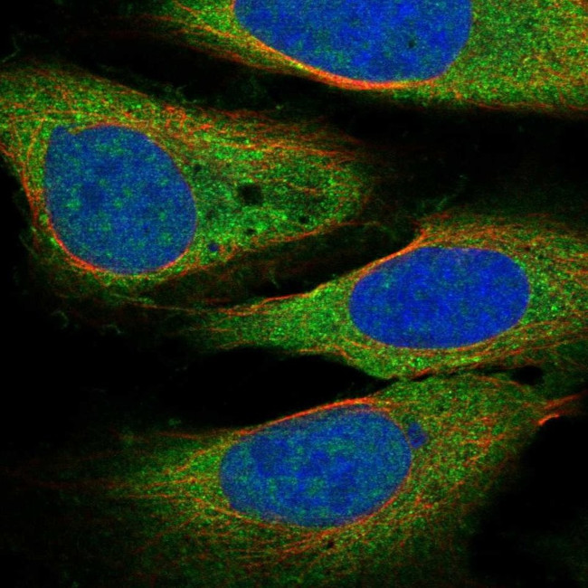 DCLK3 Antibody in Immunocytochemistry (ICC/IF)