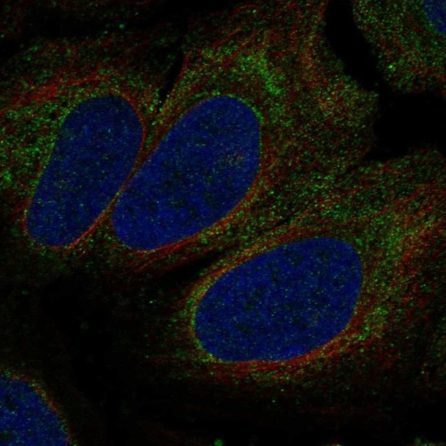 P2X1 Antibody in Immunocytochemistry (ICC/IF)