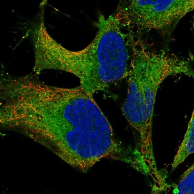 SH3PXD2B Antibody in Immunocytochemistry (ICC/IF)