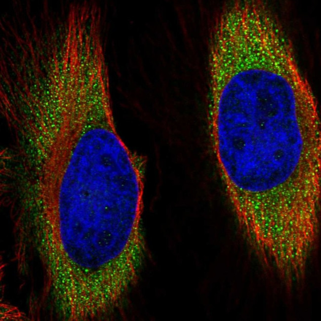 RGR Antibody in Immunocytochemistry (ICC/IF)