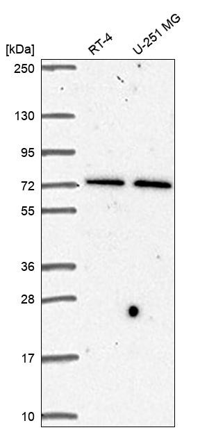 STAM Antibody in Western Blot (WB)