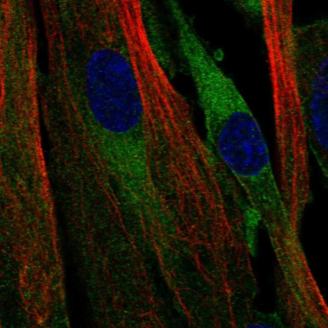 ATP8B2 Antibody in Immunocytochemistry (ICC/IF)