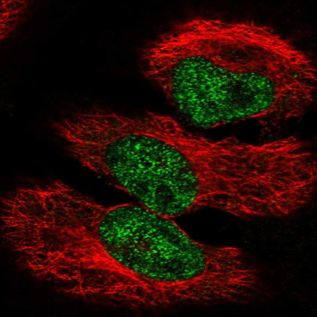 PPARGC1A Antibody in Immunocytochemistry (ICC/IF)