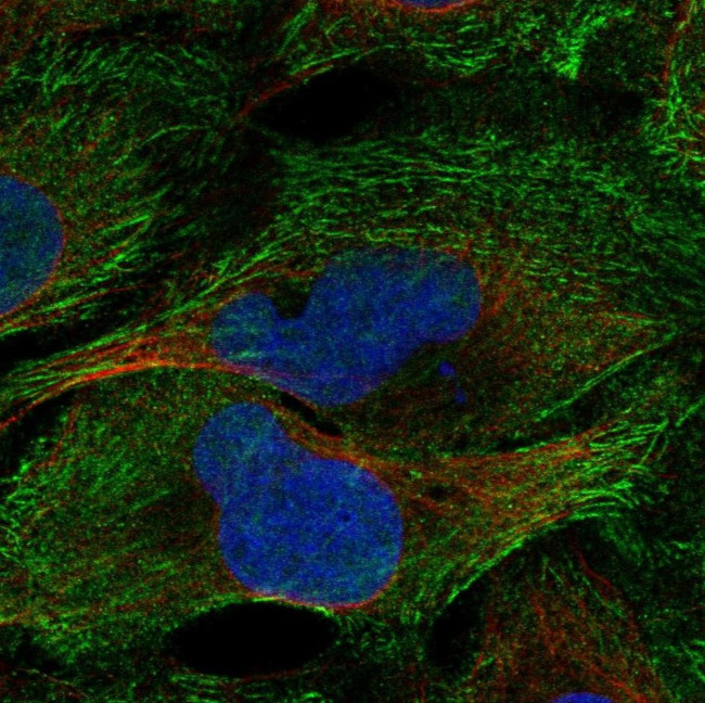 Septin 2 Antibody in Immunocytochemistry (ICC/IF)