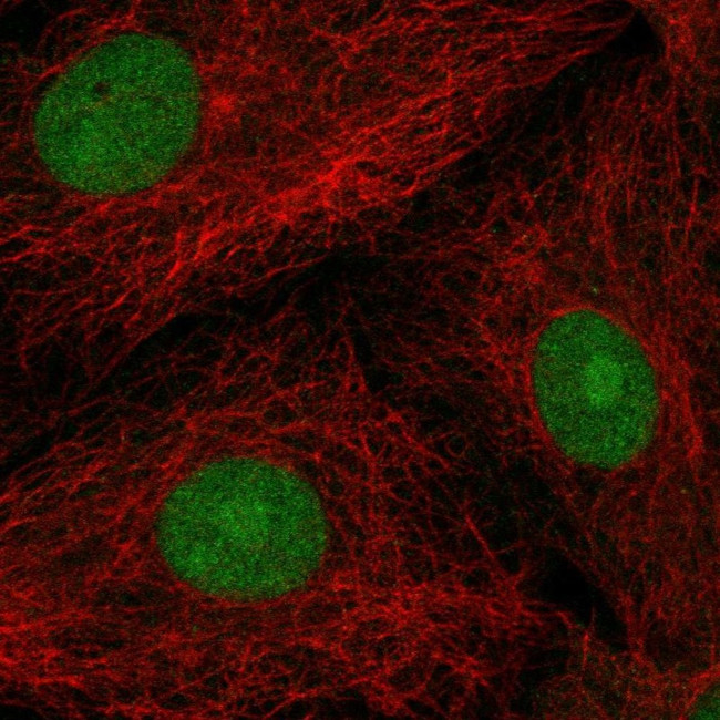 POP4 Antibody in Immunocytochemistry (ICC/IF)