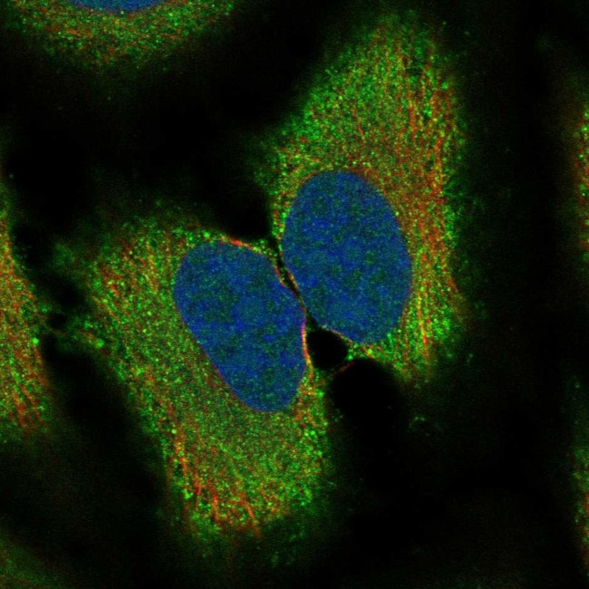 RAB41 Antibody in Immunocytochemistry (ICC/IF)