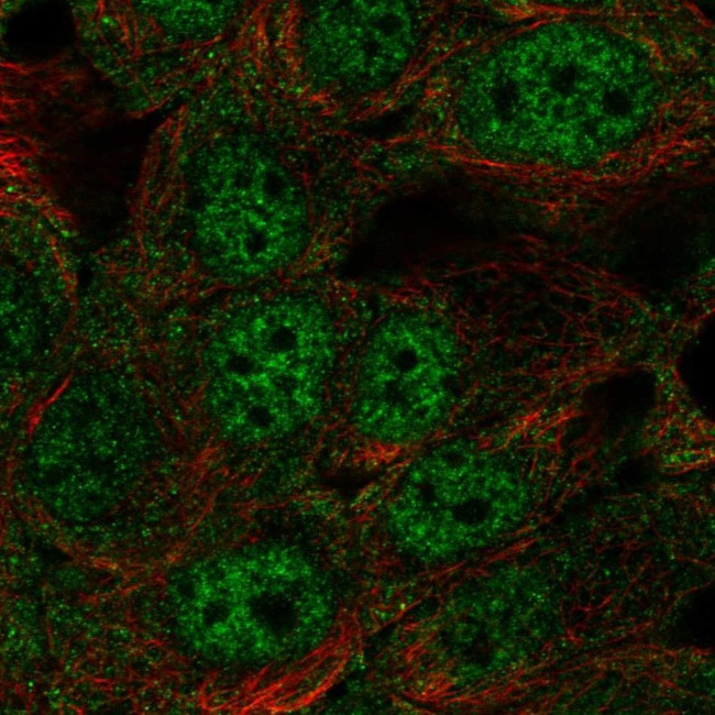 Pyrroline-5-carboxylate Reductase Antibody in Immunocytochemistry (ICC/IF)