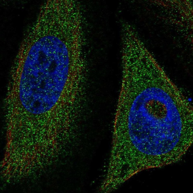 TFEB Antibody in Immunocytochemistry (ICC/IF)