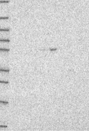 TFEB Antibody in Western Blot (WB)