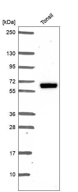 Estrogen Receptor beta Antibody in Western Blot (WB)