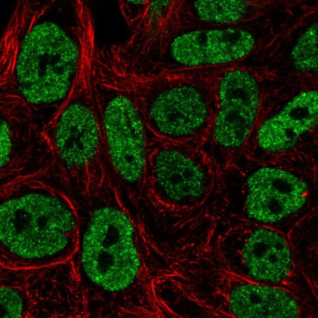 JNK3 Antibody in Immunocytochemistry (ICC/IF)