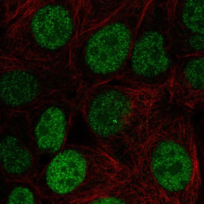 JunD Antibody in Immunocytochemistry (ICC/IF)