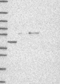 SERPINA4 Antibody in Western Blot (WB)