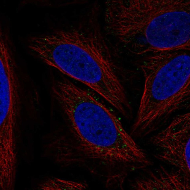 ATG12 Antibody in Immunocytochemistry (ICC/IF)