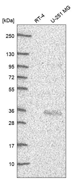 CITED2 Antibody in Western Blot (WB)
