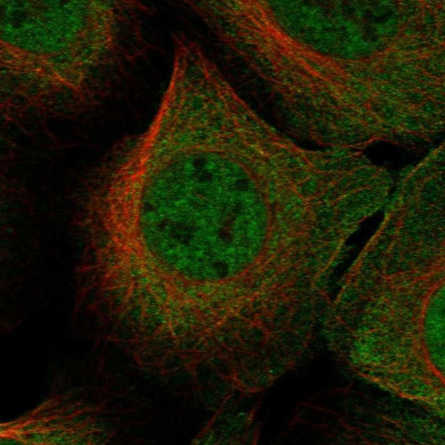 SNUPN Antibody in Immunocytochemistry (ICC/IF)