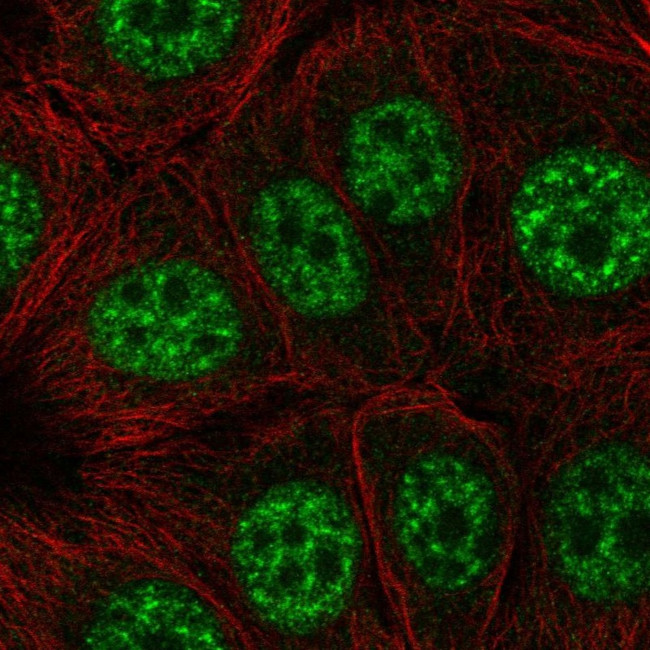 EAPP Antibody in Immunocytochemistry (ICC/IF)