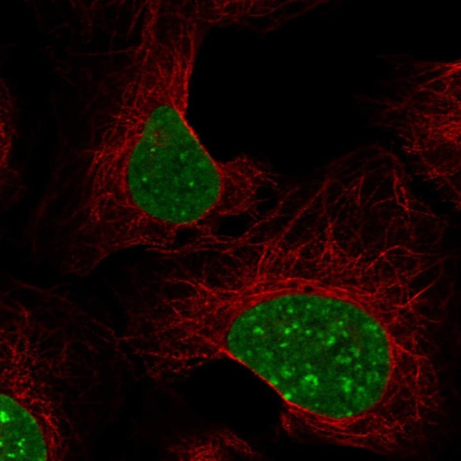 HP1 beta Antibody in Immunocytochemistry (ICC/IF)