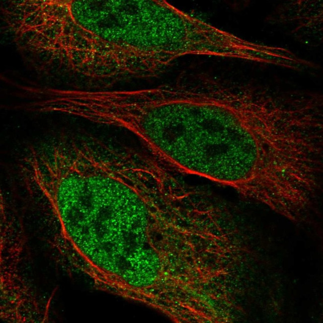 ZBTB8B Antibody in Immunocytochemistry (ICC/IF)