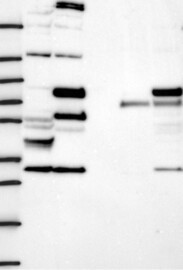 CEP63 Antibody in Western Blot (WB)