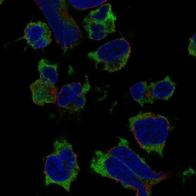 SH2D1A Antibody in Immunocytochemistry (ICC/IF)