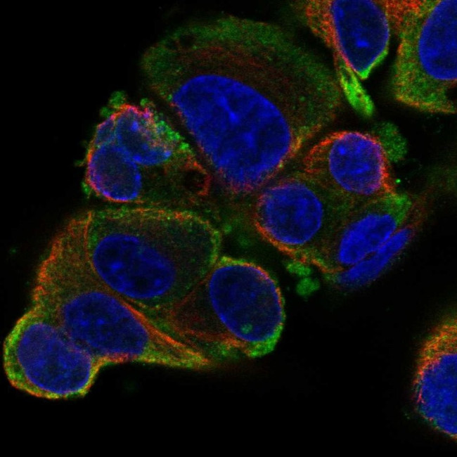 SLC26A6 Antibody in Immunocytochemistry (ICC/IF)