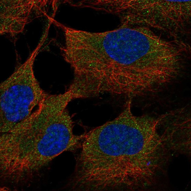 ST6GALNAC6 Antibody in Immunocytochemistry (ICC/IF)