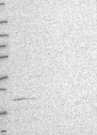 ST6GALNAC6 Antibody in Western Blot (WB)